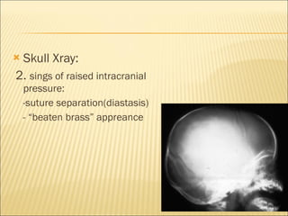 Skull Xray:  2.  sings of raised intracranial pressure: -suture separation(diastasis) - “beaten brass” appreance 