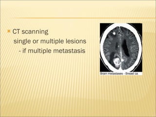 CT scanning single or multiple lesions - if multiple metastasis 