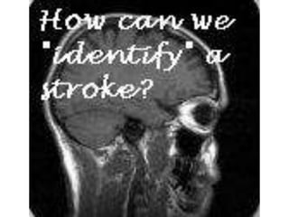 Cerebral vascular accident   stroke