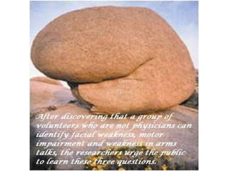 Cerebral vascular accident   stroke