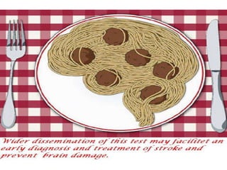 Cerebral vascular accident stroke