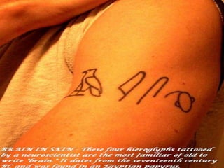 Cerebral vascular accident   stroke