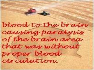 Cerebral vascular accident   stroke