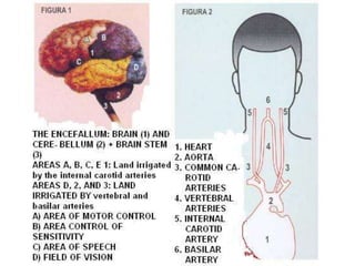 Cerebral vascular accident stroke