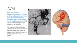 Cerebral Vascular Anatomy and CSF Pathway.pptx