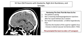 32-Year-Old Presents with Headache, Right Arm Numbness, and
Syncope.
Reviewing The Data That We Have So Far:
1. The patient is young
2. She is receiving medroxyprogesterone injections
after her recent delivery by C-section
3. Her head CT demonstrates a midline hyperdensity
that:
- Overlies the location of the superior sagittal sinus
- Crosses 2 arterial vascular territories (ACA + PCA)
This prompted the team to order a CT venogram
 