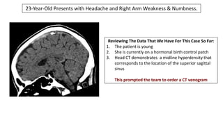Reviewing The Data That We Have For This Case So Far:
1. The patient is young
2. She is currently on a hormonal birth control patch
3. Head CT demonstrates a midline hyperdensity that
corresponds to the location of the superior sagittal
sinus
This prompted the team to order a CT venogram
23-Year-Old Presents with Headache and Right Arm Weakness & Numbness.
 