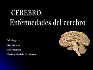 CEREBRO: Enfermedades del cerebro ,[object Object],[object Object],[object Object],[object Object]