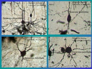 Facultad de Medicina            Facultad de Medicina
                      Universidad de la República     Universidad de la República



                                                    Neurona fusiforme

Neurona piramidal




                     Facultad de Medicina             Facultad de Medicina
                     Universidad de la República      Universidad de la República




                                                      Neurona estrellada

                    Neurona estrellada
 