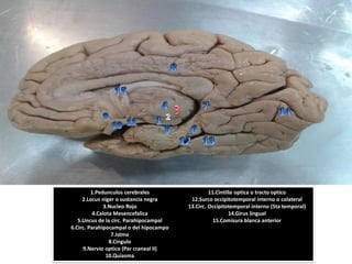 1.Pedunculos cerebrales2.Locus nigero sustancianegra3.Nucleo Rojo4.Calota Mesencefalica5.Uncus de la circ. Parahipocampal6.Circ. Parahipocampalo del hipocampo7.Istmo8.Cíngulo9.Nervio optico(Par cranealII) 10.Quiasma11.Cintilla opticao tractooptico12.Surco occipitotemporalinternoo colateral13.Circ. Occipitotemporalinterno(5ta temporal) 14.Girus lingual15.Comisura blancaanterior  