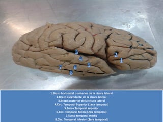 1.Brazo horizontal o anterior de la cisuralateral2.Brazo ascendentede la cisuralateral3.Brazo posterior de la cisuralateral4.Circ. Temporal Superior (1era temporal) 5.Surco Temporal superior6.Circ. Temporal Media (2da temporal) 7.Surco temporal medio8.Circ. Temporal Inferior (3era temporal)  