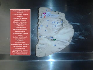1.Sustancia blanca(centrohemioval) 2.Sustancia gris(cortezacerebral) 3.Corteza de la insula4.Capsula Extrema5.Claustro o antemuro6.Capsula Externa7.Putamen8.Globo Pallidum9.Brazo posterior de la capsulainterna10.Rodilla de la capsulainterna11.Brazo anterior de la capsulainterna12.Talamo13.Forcex minor14.Asta posterior (occipital) del ventriculolateral15.Forcex mayor16.Radiaciones opticas. 17.Asta frontal (anterior) del ventriculolateral.  