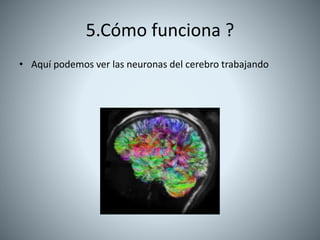 5.Cómo funciona ?
• Aquí podemos ver las neuronas del cerebro trabajando
 