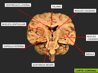 CAPSULA INTERNA
NÚCLEO LENTICULAR
SUSTANCIA NEGRA
TÁLAMO
NÚCLEO CAUDADO
ÍNSULA
CORTE CORONAL
NÚCLEO
CAUDADO
VENTRÍCULO LATERAL
 