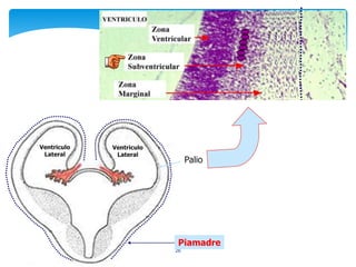 26
Palio
Ventriculo
Lateral
Ventriculo
Lateral
Piamadre
 