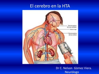 El cerebro en la HTA
Dr C. Nelson Gòmez Viera.
Neuròlogo
 