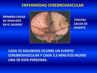 ENFERMEDAD CEREBROVASCULAR
CADA 53 SEGUNDOS OCURRE UN EVENTO
CEREBROVASCULAR Y CADA 3.3 MINUTOS MUERE
UNA DE ESTA PERSONAS.
PRIMERA CAUSA
DE INVALIDEZ
EN EL MUNDO
TERCERA
CAUSA DE
MUERTE
 