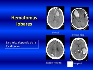 Hematomas
lobares
La clínica depende de la
localización
Frontal
Parieto-occipital Temporal
Frontal basal
 
