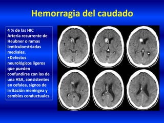 Hemorragia del caudado
4 % de las HIC
Arteria recurrente de
Heubner o ramas
lenticuloestriadas
mediales.
•Defectos
neurológicos ligeros
que pueden
confundirse con las de
una HSA, consistentes
en cefalea, signos de
irritación meníngea y
cambios conductuales.
 