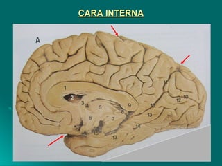 CARA INTERNACARA INTERNA
 