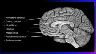 • Hemisferio cerebral
• Cuerpo calloso
• Hipotálamo
• Hipófisis
• Mesencéfalo
• Protuberancia anular
• Bulbo raquídeo
 