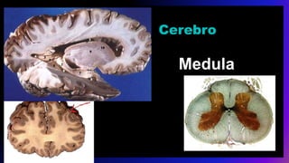 Cerebro
Medula
 