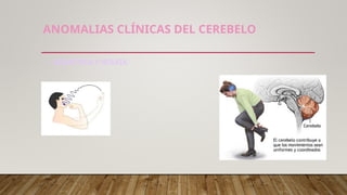 Labios Rombicos CEREBROCEREBELO.ppt_20250621_094922_0000.pptx