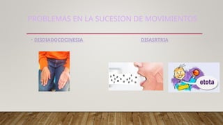 Labios Rombicos CEREBROCEREBELO.ppt_20250621_094922_0000.pptx