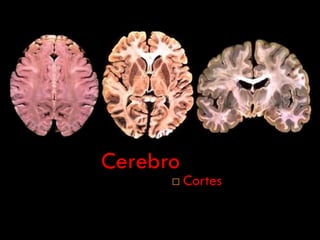 Cerebro
         Cortes
 