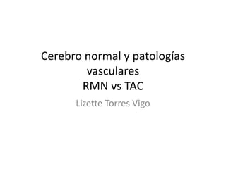 Cerebro normal y patologías
vasculares
RMN vs TAC
Lizette Torres Vigo
 