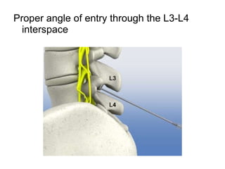 Proper angle of entry through the L3-L4 interspace  