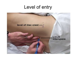 Level of entry 