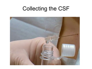Collecting the CSF 