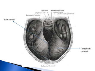 Falx cerebi




              Tentorium
              cerebeli
 