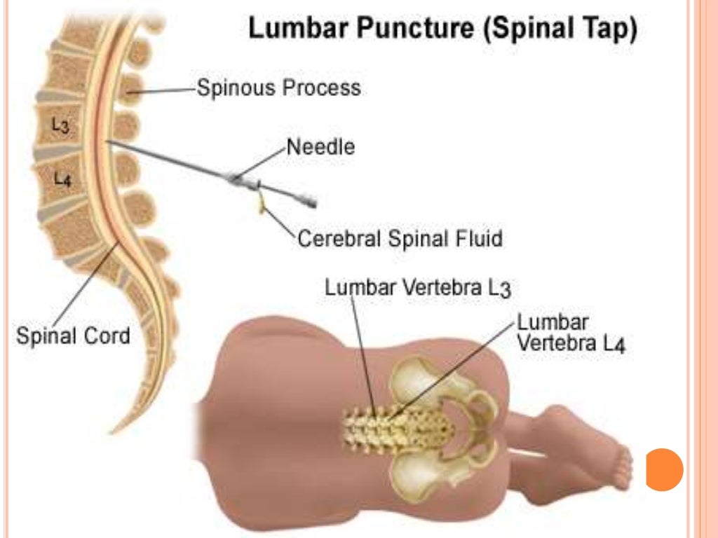 Cerebrospinal fluid