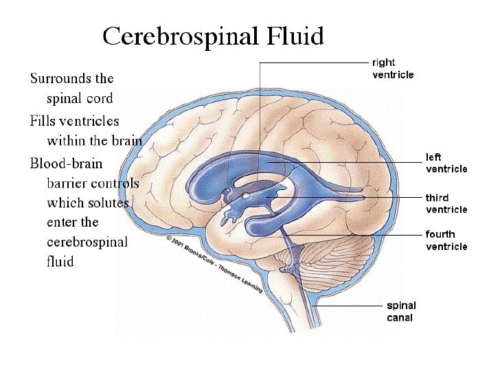 fluid is formed how tissue Cerebrospinal intracranial and pressure fluid fluid is formed how tissue Cerebrospinal intracranial and pressure fluid