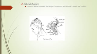 2. Cisternall Puncture
 In this a needle between the occipital bone and atlas so that it enters the cisterna
 