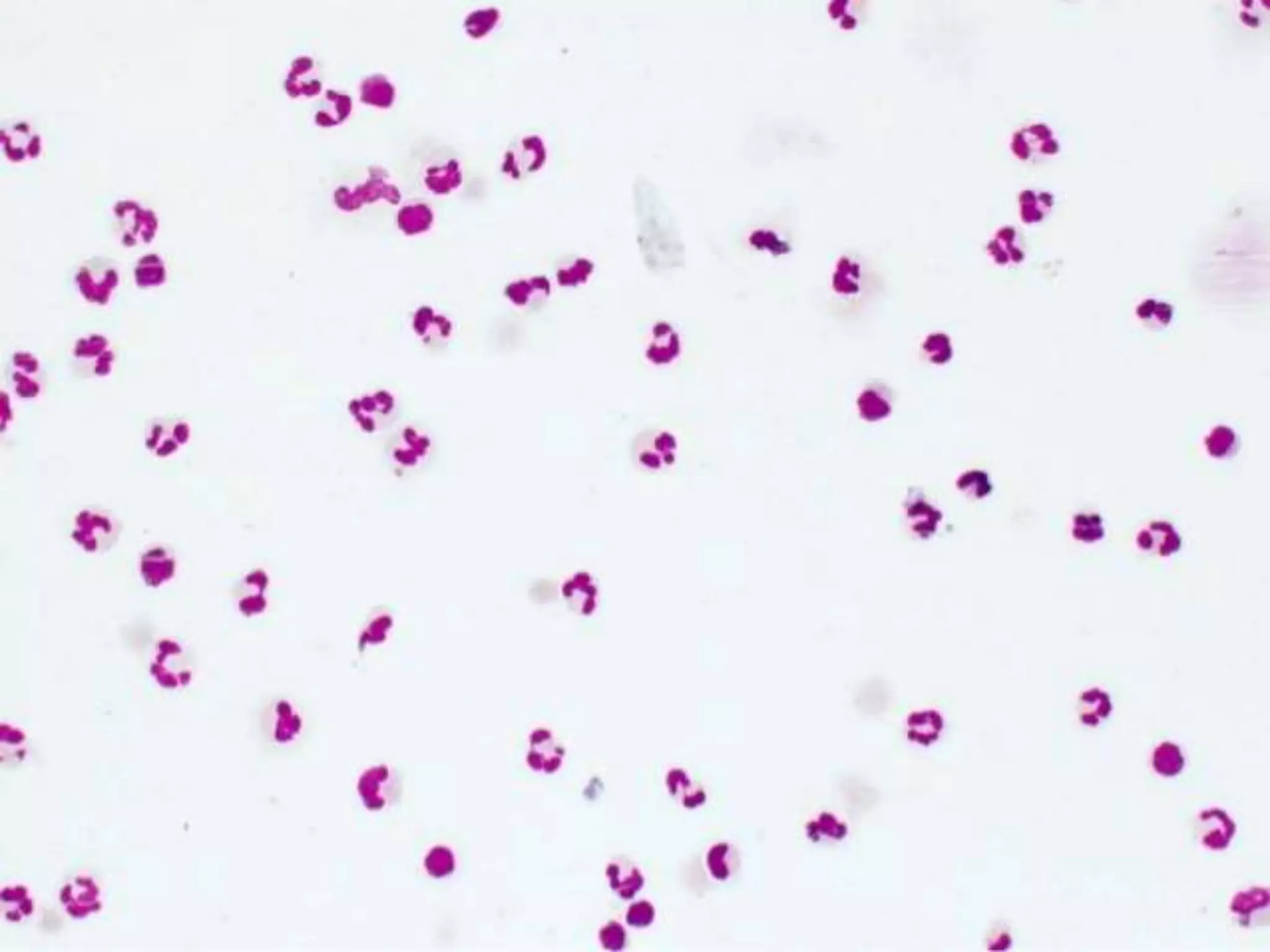 Cerebrospinal fluid (csf) examination under microscope | PPTX