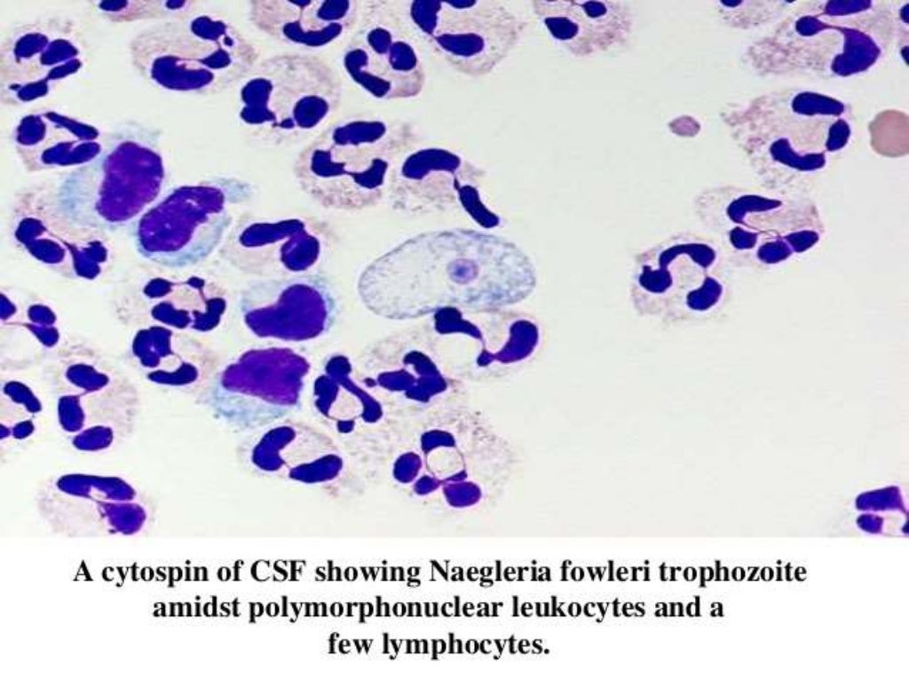 Cerebrospinal fluid (csf) examination under microscope