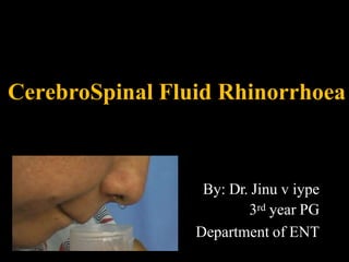 CerebroSpinal Fluid Rhinorrhoea
By: Dr. Jinu v iype
3rd year PG
Department of ENT
 