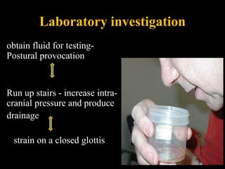 Laboratory investigation
obtain fluid for testing-
Postural provocation
Run up stairs - increase intra-
cranial pressure and produce
drainage
strain on a closed glottis
 