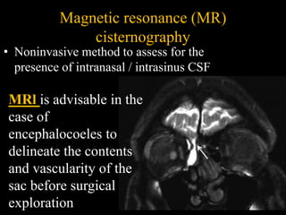 Magnetic resonance (MR)
cisternography
• Noninvasive method to assess for the
presence of intranasal / intrasinus CSF
MRl is advisable in the
case of
encephalocoeles to
delineate the contents
and vascularity of the
sac before surgical
exploration
 