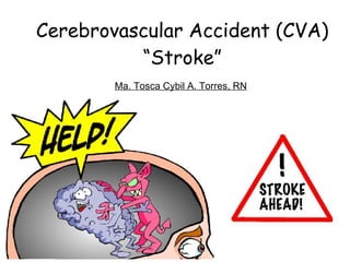 Cerebrovascular Accident (CVA) “Stroke” Ma. Tosca Cybil A. Torres, RN 