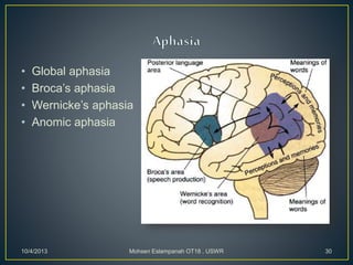 • Global aphasia
• Broca’s aphasia
• Wernicke’s aphasia
• Anomic aphasia
10/4/2013 Mohsen Eslampanah OT18 , USWR 30
 