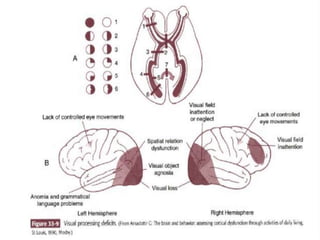 10/4/2013 Mohsen Eslampanah OT18 , USWR 41
 