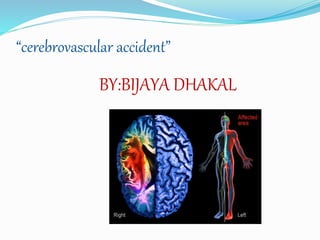 “cerebrovascular accident”
BY:BIJAYA DHAKAL
 