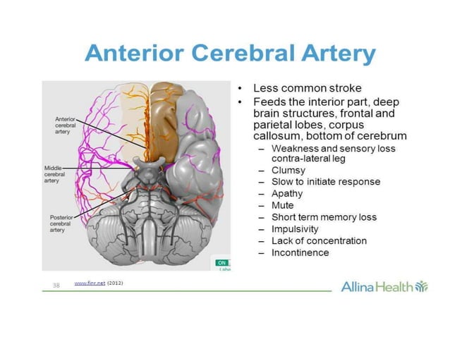 Localisation of stroke | PPTX