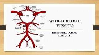 WHICH BLOOD
VESSEL?
& the NEUROLOICAL
DEFICITS
 