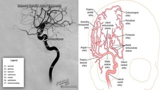 Ecvd Cerebrovascular anatomy | PPTX