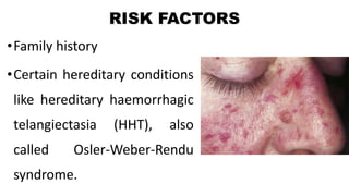 RISK FACTORS
•Family history
•Certain hereditary conditions
like hereditary haemorrhagic
telangiectasia (HHT), also
called Osler-Weber-Rendu
syndrome.
 